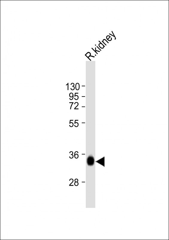 Rhodanese / TST Antibody - Anti-TST Antibody (C-Term) at 1:2000 dilution + rat kidney lysate Lysates/proteins at 20 ug per lane. Secondary Goat Anti-Rabbit IgG, (H+L), Peroxidase conjugated at 1:10000 dilution. Predicted band size: 33 kDa. Blocking/Dilution buffer: 5% NFDM/TBST.