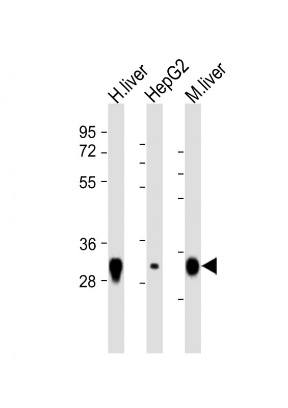 Rhodanese / TST Antibody - All lanes: Anti-TST Antibody (C-Term) at 1:8000 dilution. Lane 1: human liver lysate. Lane 2: HepG2 lysate. Lane 3: mouse liver lysate Lysates/proteins at 20 ug per lane. Secondary Goat Anti-Rabbit IgG, (H+L), Peroxidase conjugated at 1:10000 dilution. Predicted band size: 33 kDa. Blocking/Dilution buffer: 5% NFDM/TBST.