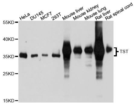 Rhodanese / TST Antibody - Western blot analysis of extracts of various cell lines, using TST antibody at 1:1000 dilution. The secondary antibody used was an HRP Goat Anti-Rabbit IgG (H+L) at 1:10000 dilution. Lysates were loaded 25ug per lane and 3% nonfat dry milk in TBST was used for blocking. An ECL Kit was used for detection and the exposure time was 5s.