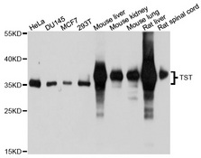 Rhodanese / TST Antibody - Western blot analysis of extracts of various cell lines, using TST antibody at 1:1000 dilution. The secondary antibody used was an HRP Goat Anti-Rabbit IgG (H+L) at 1:10000 dilution. Lysates were loaded 25ug per lane and 3% nonfat dry milk in TBST was used for blocking. An ECL Kit was used for detection and the exposure time was 5s.