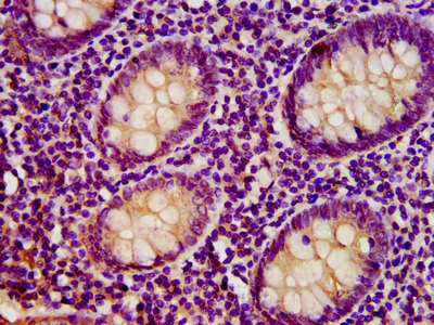 Rhodanese / TST Antibody - Immunohistochemistry image at a dilution of 1:400 and staining in paraffin-embedded human appendix tissue performed on a Leica BondTM system. After dewaxing and hydration, antigen retrieval was mediated by high pressure in a citrate buffer (pH 6.0) . Section was blocked with 10% normal goat serum 30min at RT. Then primary antibody (1% BSA) was incubated at 4 °C overnight. The primary is detected by a biotinylated secondary antibody and visualized using an HRP conjugated SP system.