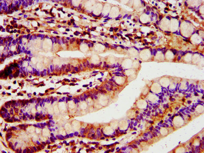 Rhodanese / TST Antibody - Immunohistochemistry image at a dilution of 1:400 and staining in paraffin-embedded human small intestine tissue performed on a Leica BondTM system. After dewaxing and hydration, antigen retrieval was mediated by high pressure in a citrate buffer (pH 6.0) . Section was blocked with 10% normal goat serum 30min at RT. Then primary antibody (1% BSA) was incubated at 4 °C overnight. The primary is detected by a biotinylated secondary antibody and visualized using an HRP conjugated SP system.