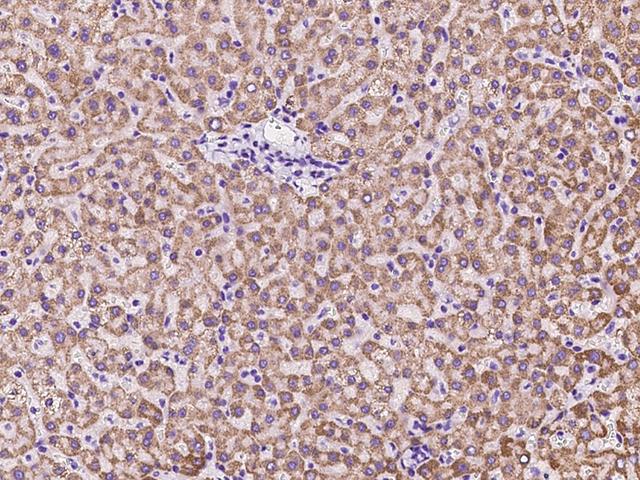 Rhodanese / TST Antibody - Immunochemical staining of human TST in human liver with rabbit polyclonal antibody at 1:1000 dilution, formalin-fixed paraffin embedded sections.