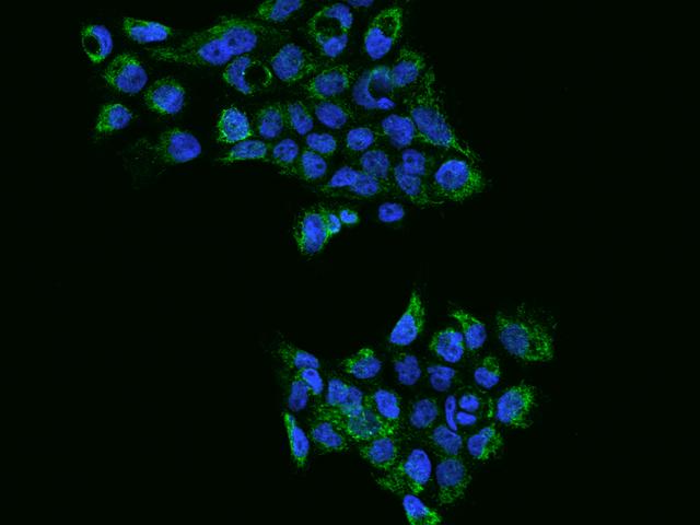 Rhodanese / TST Antibody - Immunofluorescence staining of TST in A431 cells. Cells were fixed with 4% PFA, permeabilzed with 0.1% Triton X-100 in PBS, blocked with 10% serum, and incubated with rabbit anti-Human TST polyclonal antibody (dilution ratio 1:200) at 4°C overnight. Then cells were stained with the Alexa Fluor 488-conjugated Goat Anti-rabbit IgG secondary antibody (green) and counterstained with DAPI (blue). Positive staining was localized to Cytoplasm.