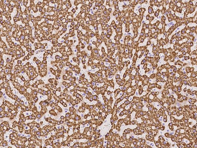 Rhodanese / TST Antibody - Immunochemical staining of human TST in human liver with rabbit polyclonal antibody at 1:500 dilution, formalin-fixed paraffin embedded sections.