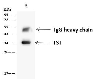 Rhodanese / TST Antibody - TST was immunoprecipitated using: Lane A: 0.5 mg HeLa Whole Cell Lysate. 4 uL anti-TST rabbit polyclonal antibody and 60 ug of Immunomagnetic beads Protein A/G. Primary antibody: Anti-TST rabbit polyclonal antibody, at 1:100 dilution. Secondary antibody: Goat Anti-Rabbit IgG (H+L)/HRP at 1/10000 dilution. Developed using the ECL technique. Performed under reducing conditions. Predicted band size: 33 kDa. Observed band size: 34 kDa.