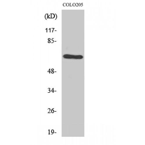 Rhodopsin Kinase / GRK1 Antibody - Western blot of GRK 1 antibody