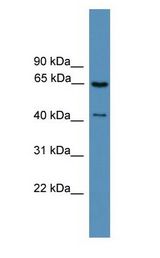 Rhodopsin Kinase / GRK1 Antibody - Rhodopsin Kinase / GRK1 antibody Western Blot of Jurkat.  This image was taken for the unconjugated form of this product. Other forms have not been tested.