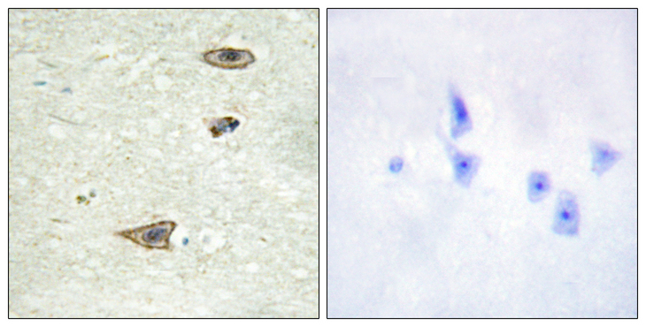 Rhodopsin Kinase / GRK1 Antibody - Immunohistochemistry analysis of paraffin-embedded human brain tissue, using GRK1 Antibody. The picture on the right is blocked with the synthesized peptide.