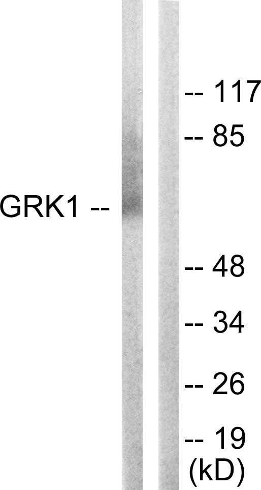Rhodopsin Kinase / GRK1 Antibody - Western blot analysis of lysates from COLO205 cells, using GRK1 Antibody. The lane on the right is blocked with the synthesized peptide.