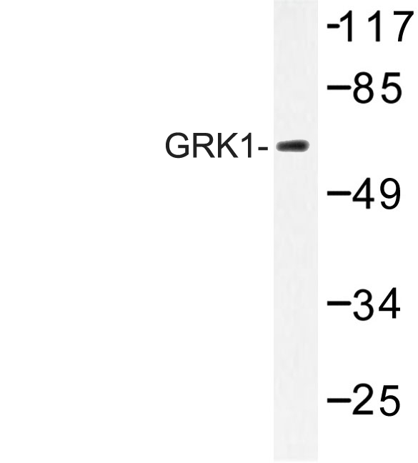 Rhodopsin Kinase / GRK1 Antibody - Western blot of GRK1 (A17) pAb in extracts from HUVEC cells.
