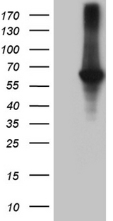 Rhodopsin Kinase / GRK1 Antibody - HEK293T cells were transfected with the pCMV6-ENTRY control. (Left lane) or pCMV6-ENTRY GRK1. (Right lane) cDNA for 48 hrs and lysed