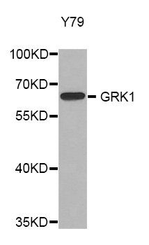 Rhodopsin Kinase / GRK1 Antibody - Western blot analysis of extracts of Y79 cells.