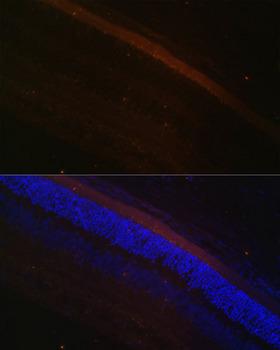Rhodopsin Kinase / GRK1 Antibody - Immunofluorescence analysis of Rat retina using GRK1 Polyclonal Antibody at dilution of 1:100 (40x lens).Blue: DAPI for nuclear staining.