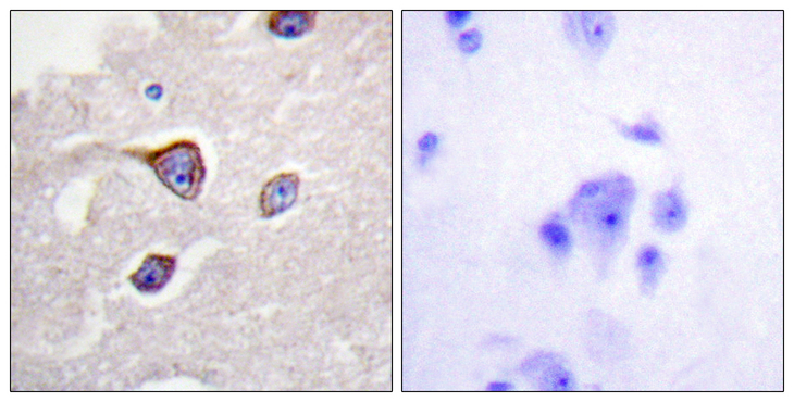 Rhodopsin Kinase / GRK1 Antibody - Immunohistochemistry analysis of paraffin-embedded human brain, using GRK1 (Phospho-Ser21) Antibody. The picture on the right is blocked with the phospho peptide.