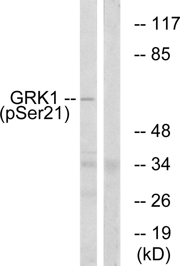 Rhodopsin Kinase / GRK1 Antibody - Western blot analysis of lysates from COS7 cells treated with TNF 20ng/ml 5', using GRK1 (Phospho-Ser21) Antibody. The lane on the right is blocked with the phospho peptide.
