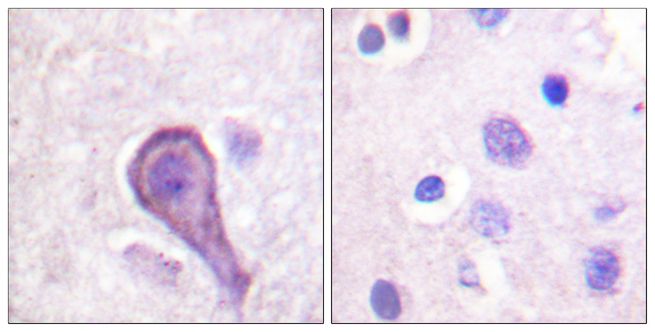 Rhodopsin / RHO Antibody - Immunohistochemistry analysis of paraffin-embedded human brain tissue, using Rhodopsin Antibody. The picture on the right is blocked with the synthesized peptide.