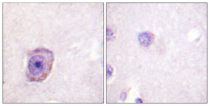 Rhodopsin / RHO Antibody - Immunohistochemistry analysis of paraffin-embedded human brain, using Rhodopsin (Phospho-Ser334) Antibody. The picture on the right is blocked with the phospho peptide.