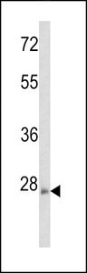 RHOE / RND3 Antibody - Western blot of ARHE Antibody in mouse brain tissue lysates (35 ug/lane). ARHE (arrow) was detected using the purified antibody.