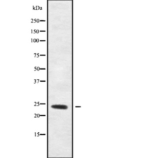 RHOF Antibody - Western blot analysis of RHOF using Jurkat whole cells lysates