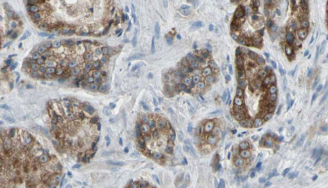 RHOF Antibody - 1:100 staining human prostate tissue by IHC-P. The sample was formaldehyde fixed and a heat mediated antigen retrieval step in citrate buffer was performed. The sample was then blocked and incubated with the antibody for 1.5 hours at 22°C. An HRP conjugated goat anti-rabbit antibody was used as the secondary.