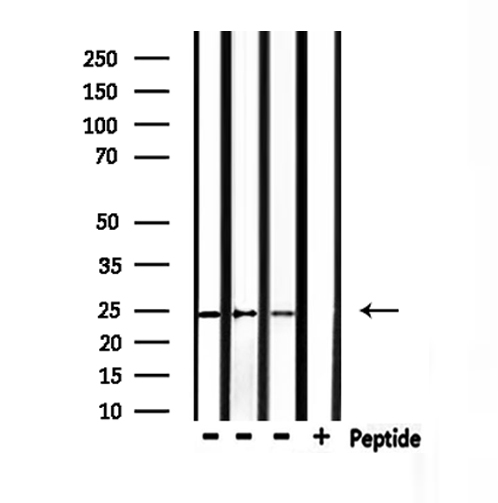 RHOF Antibody - Western blot analysis of extracts of rat spleen, mouse spleen, rat spleen using RHOF antibody.