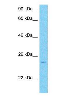 RHOF Antibody - Western blot of RHOF Antibody with human Lymph Node Tumor lysate.  This image was taken for the unconjugated form of this product. Other forms have not been tested.