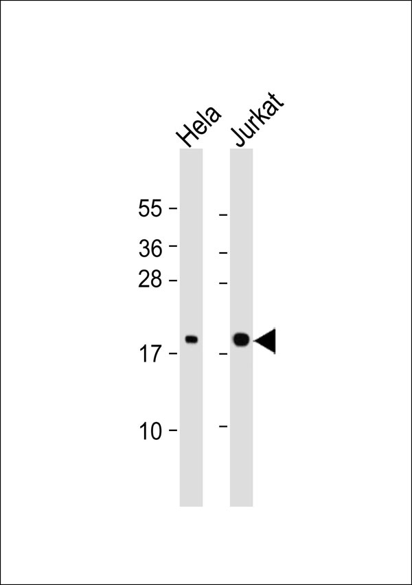 RHOG / ARHG Antibody - All lanes: Anti-RhoG Antibody at 1:1000 dilution. Lane 1: HeLa whole cell lysate. Lane 2: Jurkat whole cell lysate Lysates/proteins at 20 ug per lane. Secondary Goat Anti-Rabbit IgG, (H+L), Peroxidase conjugated at 1:10000 dilution. Predicted band size: 21 kDa. Blocking/Dilution buffer: 5% NFDM/TBST.