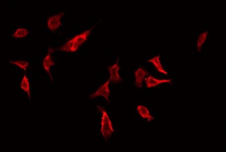 RHOG / ARHG Antibody - Staining HeLa cells by IF/ICC. The samples were fixed with PFA and permeabilized in 0.1% Triton X-100, then blocked in 10% serum for 45 min at 25°C. The primary antibody was diluted at 1:200 and incubated with the sample for 1 hour at 37°C. An Alexa Fluor 594 conjugated goat anti-rabbit IgG (H+L) Ab, diluted at 1/600, was used as the secondary antibody.
