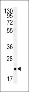 RHOQ / TC10 Antibody - TC10 Antibody western blot of T47D cell line lysates (35 ug/lane). The TC10 antibody detected the TC10 protein (arrow).