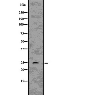 RHOQ / TC10 Antibody - Western blot analysis of RHOQ using COLO205 whole lysates.