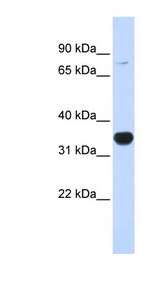 RHOT1 Antibody - RHOT1 antibody Western blot of 293T cell lysate. This image was taken for the unconjugated form of this product. Other forms have not been tested.