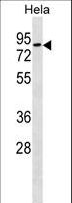 RHOT1 Antibody - RHOT1 Antibody western blot of HeLa cell line lysates (35 ug/lane). The RHOT1 antibody detected the RHOT1 protein (arrow).