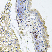 RHOT1 Antibody - Immunohistochemistry of paraffin-embedded mouse lung tissue.