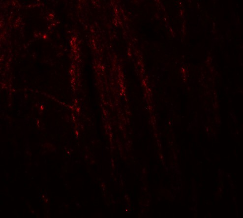 RHOT1 Antibody - Immunofluorescence of RHOT in mouse brain tissue with RHOT antibody at 20 ug/ml.