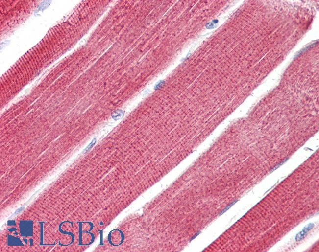 RHOT1 Antibody - Anti-RHOT1 antibody IHC of human skeletal muscle. Immunohistochemistry of formalin-fixed, paraffin-embedded tissue after heat-induced antigen retrieval. Antibody dilution 5-10 ug/ml. This image was taken for the unconjugated form of this product. Other forms have not been tested.