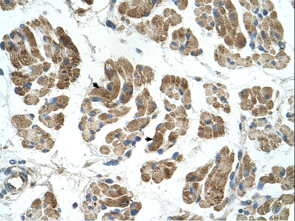 RHOT1 Antibody - RHOT1 antibody RHOT1(ras homolog gene family, member T1) Antibody was used in IHC to stain formalin-fixed, paraffin-embedded human muscle.  This image was taken for the unconjugated form of this product. Other forms have not been tested.
