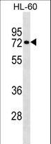 RHOT2 Antibody - RHOT2 Antibody western blot of HL-60 cell line lysates (35 ug/lane). The RHOT2 antibody detected the RHOT2 protein (arrow).