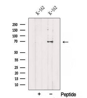 RHOT2 Antibody - Western blot analysis of extracts of K562 cells using RHOT2 antibody. The lane on the left was treated with blocking peptide.