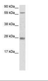 Rhox11 Antibody - SP2/0 Cell Lysate.  This image was taken for the unconjugated form of this product. Other forms have not been tested.
