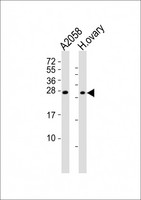 RHOXF1 Antibody - All lanes : Anti-RHOXF1 Antibody at 1:2000 dilution Lane 1: A2058 whole cell lysates Lane 2: human ovary lysates Lysates/proteins at 20 ug per lane. Secondary Goat Anti-Rabbit IgG, (H+L), Peroxidase conjugated at 1/10000 dilution Predicted band size : 21 kDa Blocking/Dilution buffer: 5% NFDM/TBST.