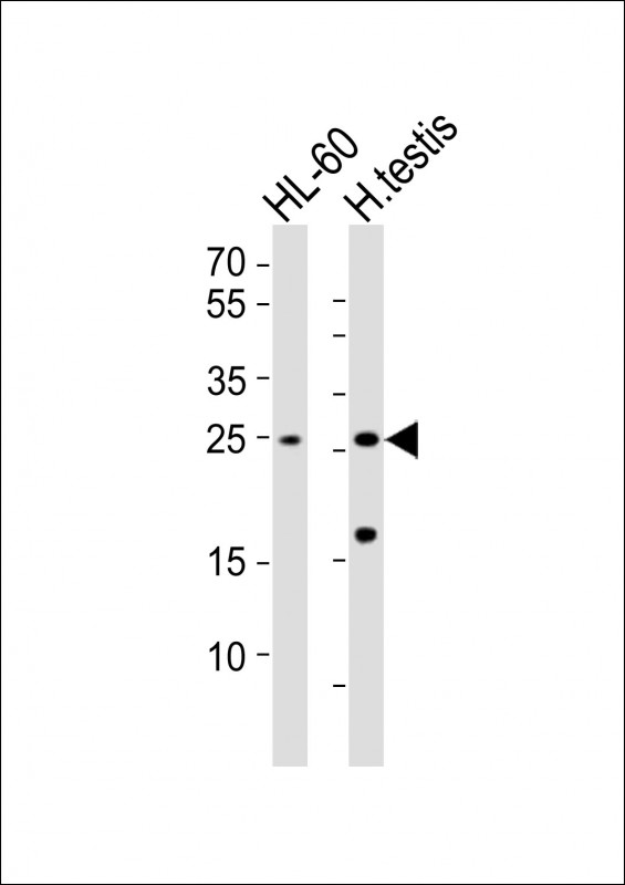 RHOXF1 Antibody - All lanes : Anti-RHOXF1 Antibody at 1:1000 dilution Lane 1: HL-60 whole cell lysates Lane 2: human testis lysates Lysates/proteins at 20 ug per lane. Secondary Goat Anti-Rabbit IgG, (H+L), Peroxidase conjugated at 1/10000 dilution Predicted band size : 21 kDa Blocking/Dilution buffer: 5% NFDM/TBST.