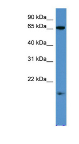 RHOXF1 Antibody - RHOXF1 antibody Western blot of Jurkat lysate. This image was taken for the unconjugated form of this product. Other forms have not been tested.