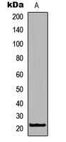 RHOXF1 Antibody - Western blot analysis of RhoXF1 expression in Jurkat (A) whole cell lysates.