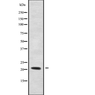 RHOXF1 Antibody - Western blot analysis of RHOXF1 using LOVO cells whole cells lysates