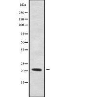 RHOXF1 Antibody - Western blot analysis of RHOXF1 using LOVO cells whole cells lysates