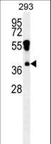 RHOXF2 Antibody - RHOXF2 Antibody western blot of 293 cell line lysates (35 ug/lane). The RHOXF2 antibody detected the RHOXF2 protein (arrow).