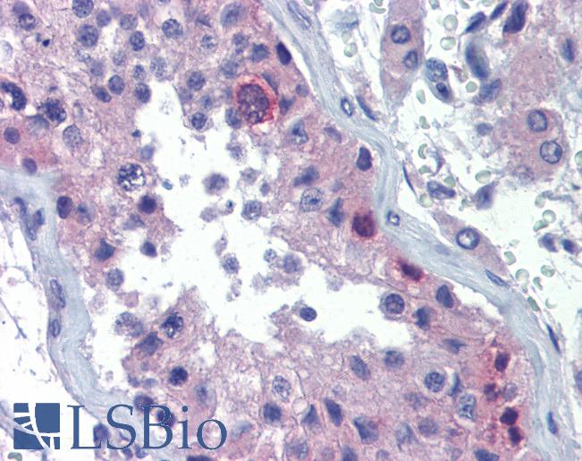 RHOXF2 Antibody - Anti-RHOXF2 antibody IHC of human testis. Immunohistochemistry of formalin-fixed, paraffin-embedded tissue after heat-induced antigen retrieval. Antibody concentration 10 ug/ml.  This image was taken for the unconjugated form of this product. Other forms have not been tested.