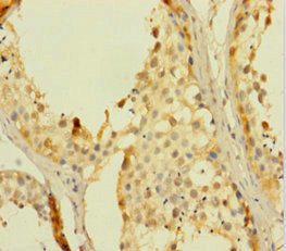 RHOXF2 Antibody - Immunohistochemistry of paraffin-embedded human testis tissue using RHOXF2 Antibody at dilution of 1:100
