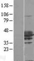 RHOXF2 Protein - Western validation with an anti-DDK antibody * L: Control HEK293 lysate R: Over-expression lysate